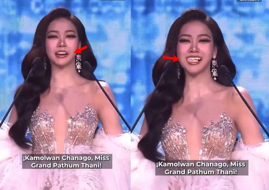 选美佳丽致词&ldquo;牙贴突脱落&rdquo; 临危不乱霸气赢喝采